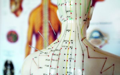 Akupunkturtag „Bewegungsapparat“ am 21.03.2026